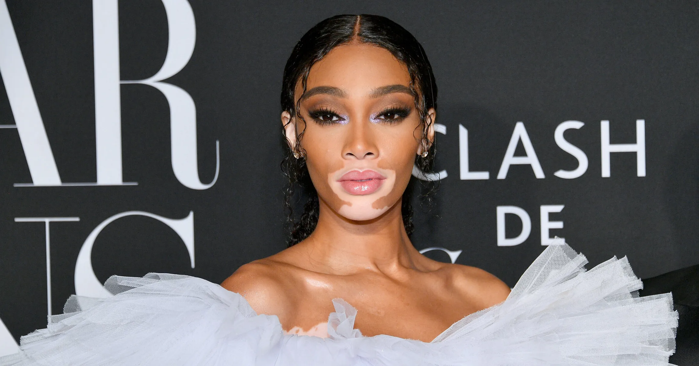 Winnie Harlow Net Worth 2024 What Is The Model Worth?